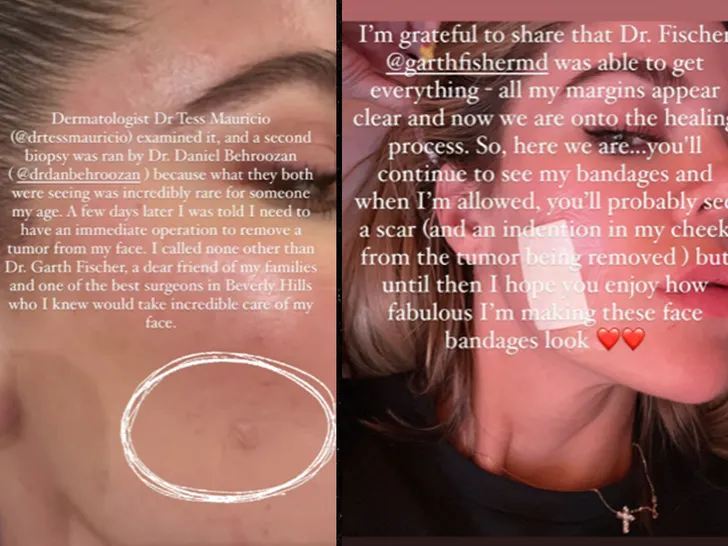 Khloé Kardashian got her face tumor removed after doctors deemed it as 'incredibly rare'